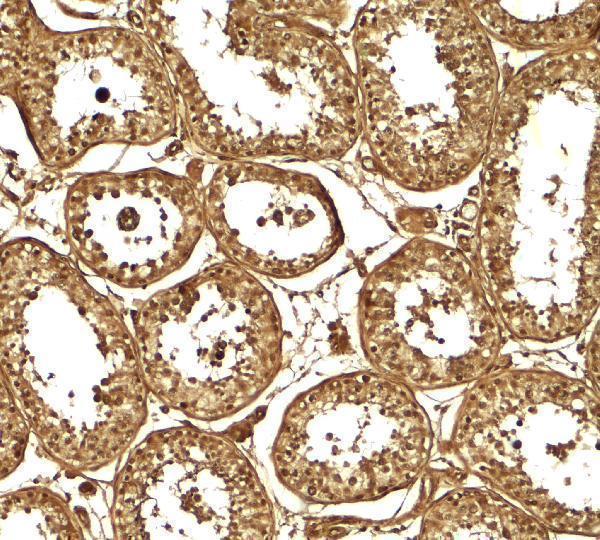 a07362 akap4 primary antibodies ihc testing 2
