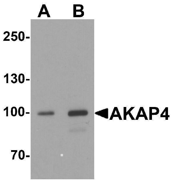 a07362 akap4 primary antibodies wb testing 1