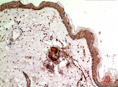 Immunohistochemical analysis of paraffin-embedded human-skin, antibody was diluted at 1:100