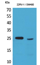 Western Blot analysis of 22RV-1, SW480 cells using SSX Polyclonal Antibody