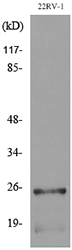 Western blot analysis of lysate from 22RV-1 cells, using SSX1/2/3/4/5/6/7/8/9 Antibody