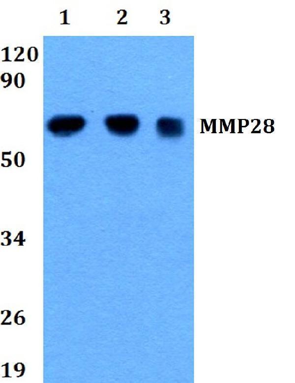Western blot (WB) analysis of MMP28 polyclonal antibody at 1:500 dilution
Lane1:HEK293T whole cell lysate
Lane2:Raw264