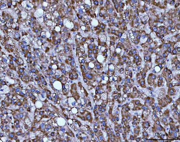  IHC analysis of BBS9 using anti-BBS9 antibody (A07367-2)