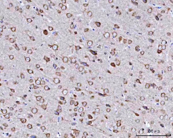a07367 2 bbs9 primary antibodies ihc testing 7