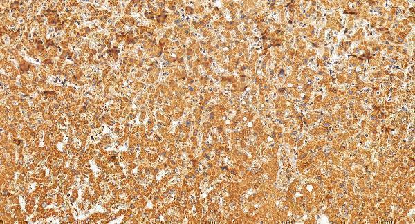 IHC analysis of BBS9 using anti-BBS9 antibody (A07367-2)