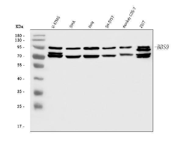  Western blot analysis of BBS9 using anti-BBS9 antibody (A07367-2)