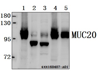 Western blot (WB) analysis of MUC20 polyclonal antibody at 1:500 dilution
Lane1:HEK293T whole cell lysate(40ug)
Lane2:The kidney tissue lysate of Mouse(40ug)
Lane3:The kidney tissue lysate of Rat(40ug)
Lane4:A549 whole cell lysate(40ug)
Lane5:L02 whole cell lysate(40ug)