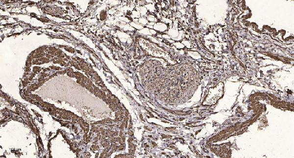 Immunohistochemical analysis of paraffin-embedded human oophoroma