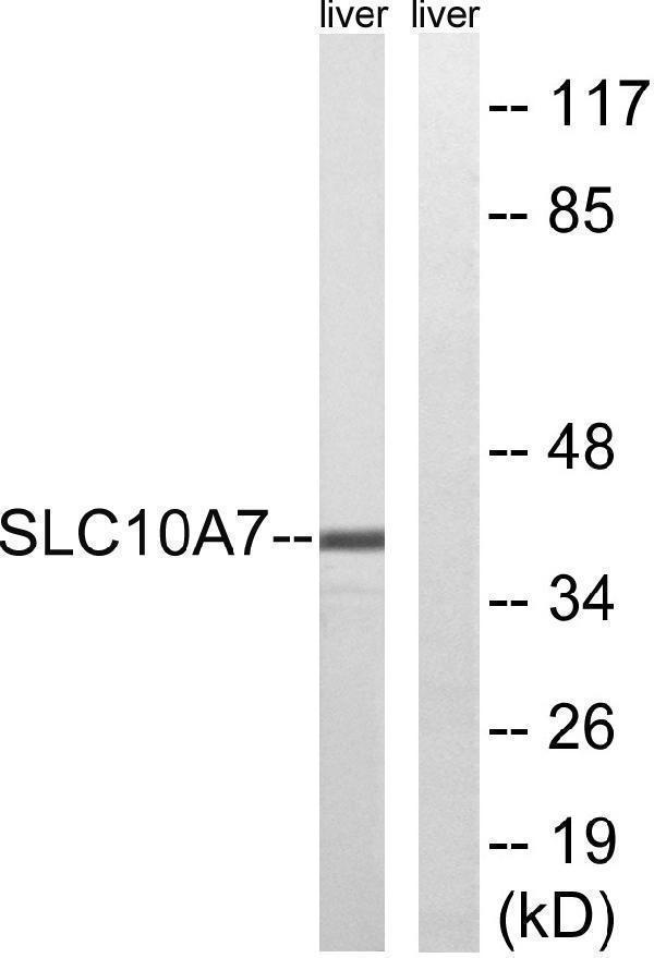 Western blot analysis of lysates from mouse liver, using SLC10A7 Antibody