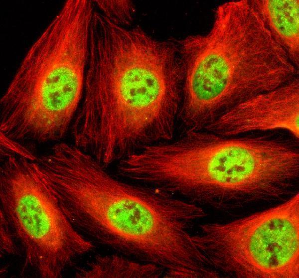 IF analysis of STK33 using anti-STK33 antibody (A07375-2) and anti-Beta Tubulin antibody (M01857-3)