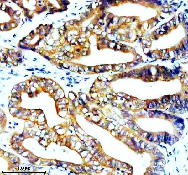 IHC analysis of STK33 using anti-STK33 antibody (A07375-2)