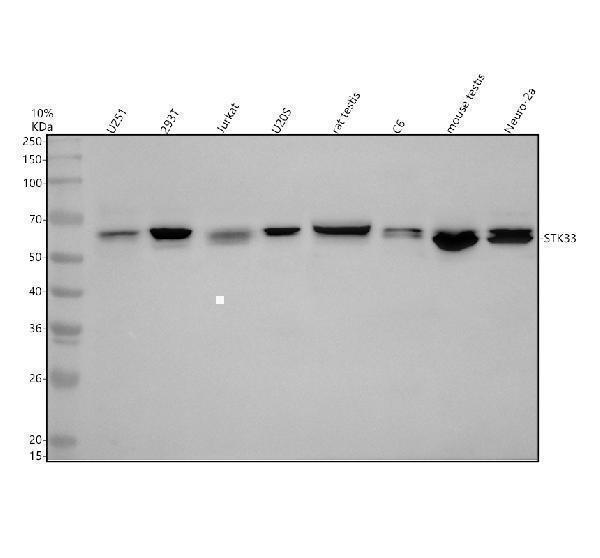 Western blot analysis of STK33 using anti-STK33 antibody (A07375-2)