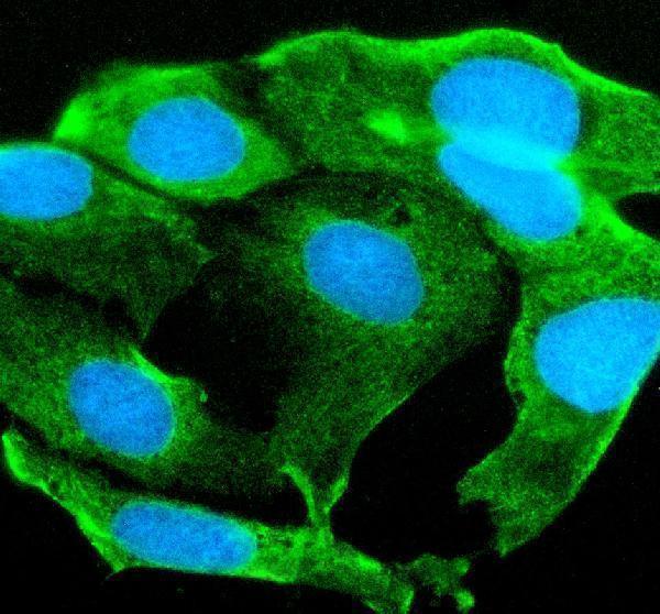 IF analysis of STYK1 using anti-STYK1 antibody (A07376-2)