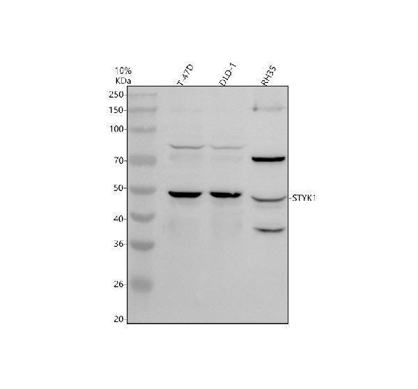 Western blot analysis of STYK1 using anti-STYK1 antibody (A07376-2)