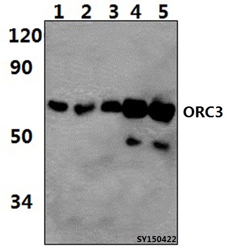 Western blot (WB) analysis of ORC3 polyclonal antibody at 1:1000 dilution
Lane1:HEK293T whole cell lysate (56