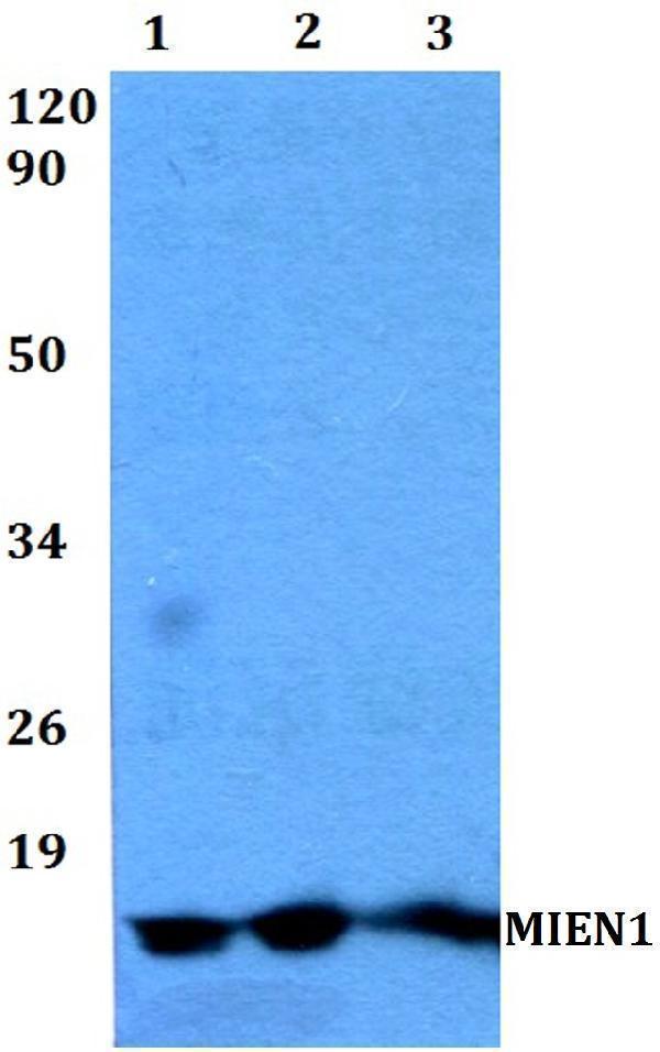 Western blot (WB) analysis of MIEN1 polyclonal antibody at 1:500 dilution
Lane1:MCF-7 whole cell lysate
Lane2:sp2/0 whole cell lysate 
Lane3:PC12 whole cell lysate 