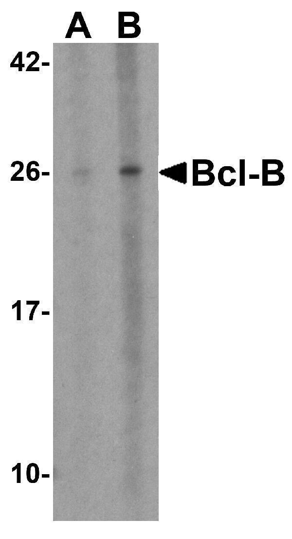 Western blot analysis of Bcl-B in Jurkat cell lysate with Bcl-B antibody at (A) 1 and (B) 2 μg/mL