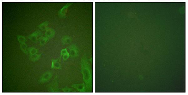 Immunofluorescence analysis of A549 cells, using Synuclein beta Antibody