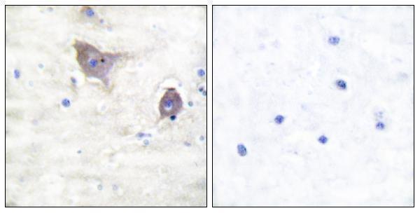 Immunohistochemistry analysis of paraffin-embedded human brain tissue, using Synuclein beta Antibody