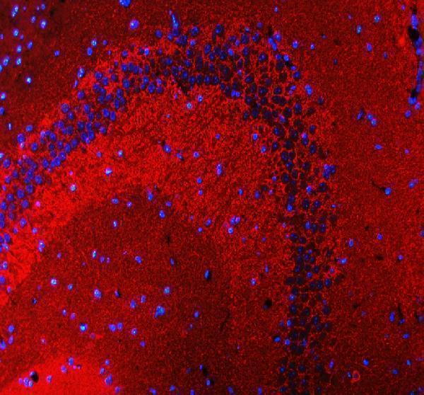 a07381 2 sncb primary antibodies if testing 1