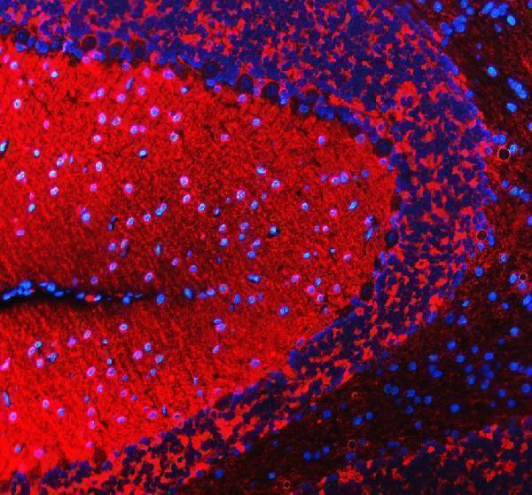a07381 2 sncb primary antibodies if testing 3