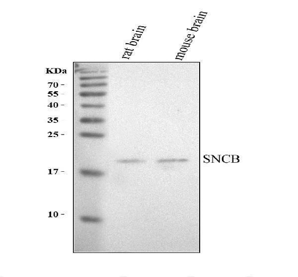 Western blot analysis of SNCB using anti-SNCB antibody (A07381-2)