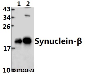 a07381s118 sncb primary antiboties wb testing 1