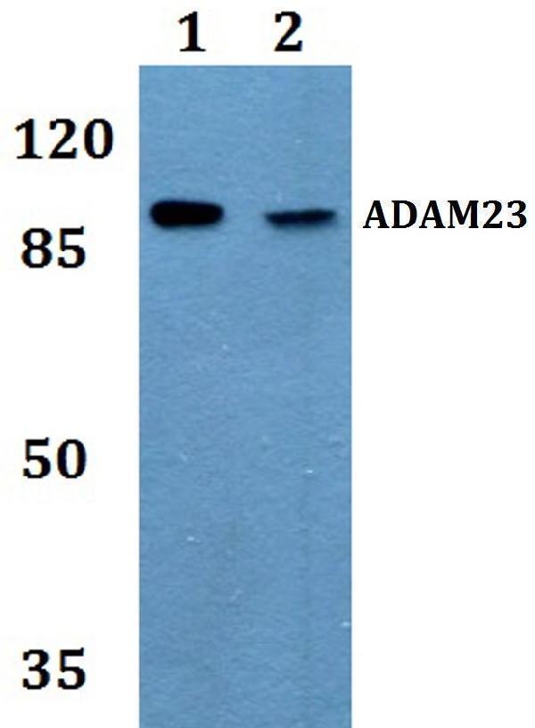 Western blot (WB) analysis of ADAM23 polyclonal antibody at 1:500 dilution
Lane1:MCF-7 whole cell lysate
Lane2:Raw264