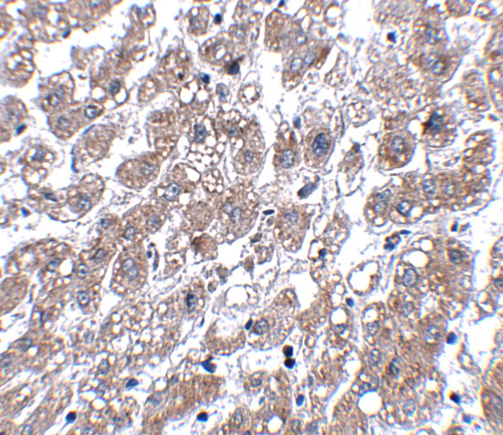 Immunohistochemistry of MATN1 in human liver tissue with MATN1 antibody at 5 μg/mL