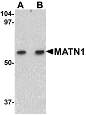 Western blot analysis of MATN1 in rat liver tissue lysate with MATN1 antibody at (A) 1 and (B) 2 μg/mL