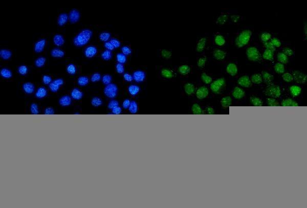 a07389 2 mettl14 primary antibodies if testing 3