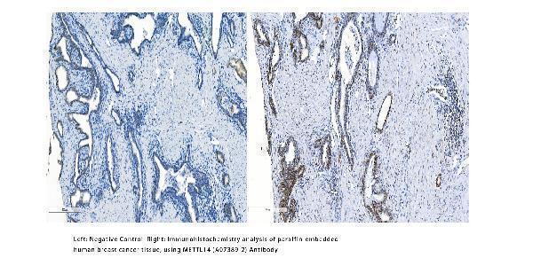 a07389 2 mettl14 primary antibodies ihc testing 2