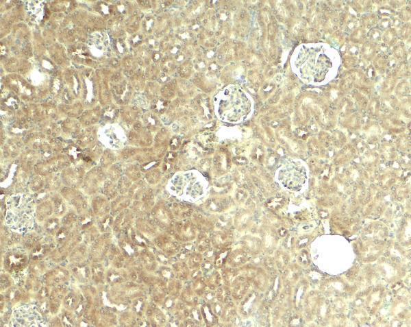 a07390 glis2 primary antibodies ihc testing 2