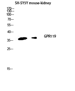 a07391 gpr119 primary antibodyes wb testing 1