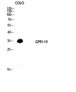 a07391 gpr119 primary antibodyes wb testing 2