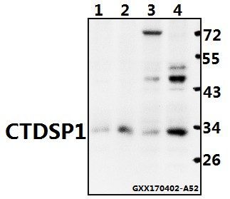 a07398 ctdsp1 primary antiboties wb testing 1