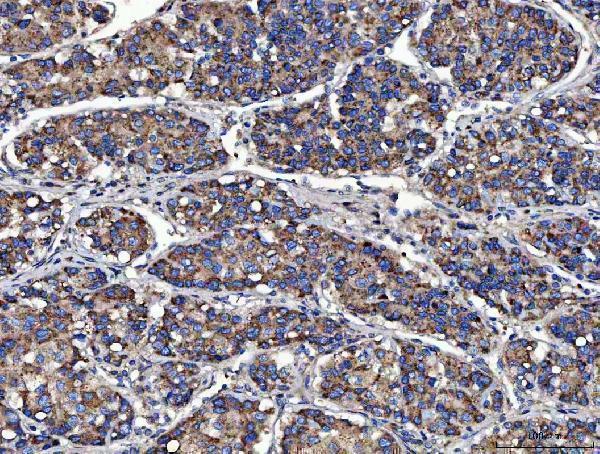  IHC analysis of MOCS2 using anti-MOCS2 antibody (A07401)