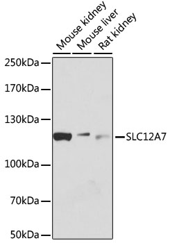 a07403 slc12a7 primary antiboties wb testing 1