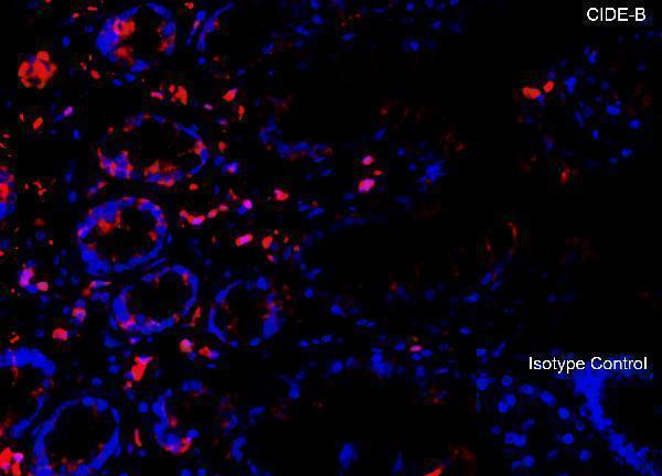 a07404 1 cideb primary antibodies if testing 1