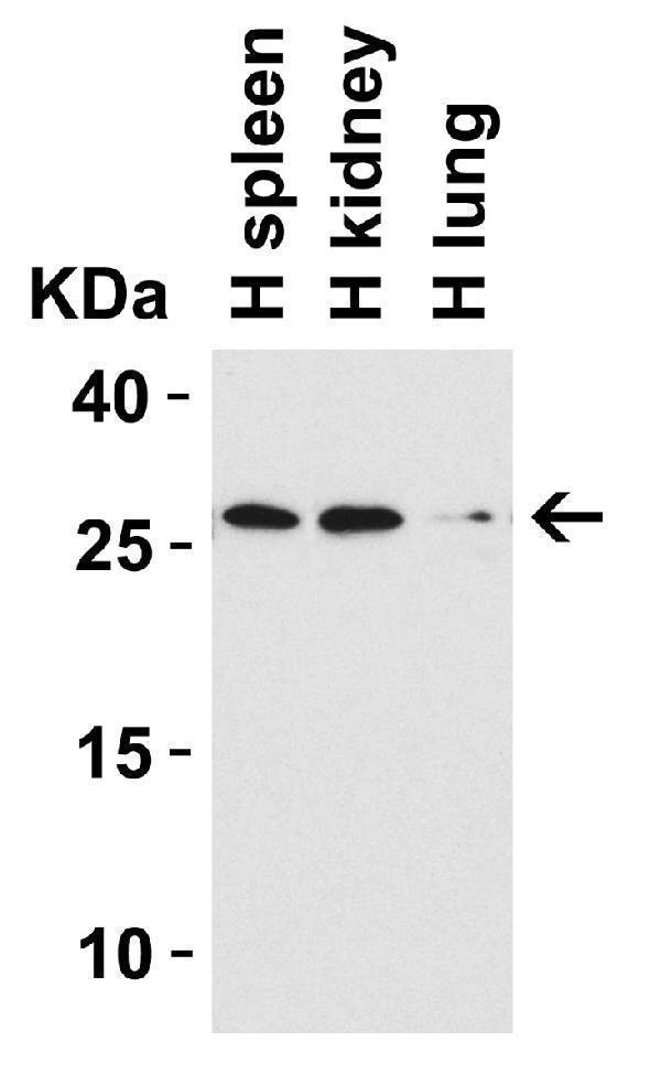 WB Validation in Human Tissues
Loading: 15 μg of lysate Antibodies: CIDE-B, A07404-1, 1 μ g/mL , 1 h incubation at RT in 5% NFDM/TBST