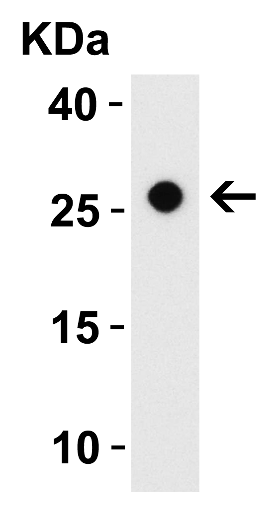 WB Validation in Mouse Small Intestine
Loading: 15 μg of lysate Antibodies: CIDE-B, A07404-1, 1 μ g/mL , 1 h incubation at RT in 5% NFDM/TBST