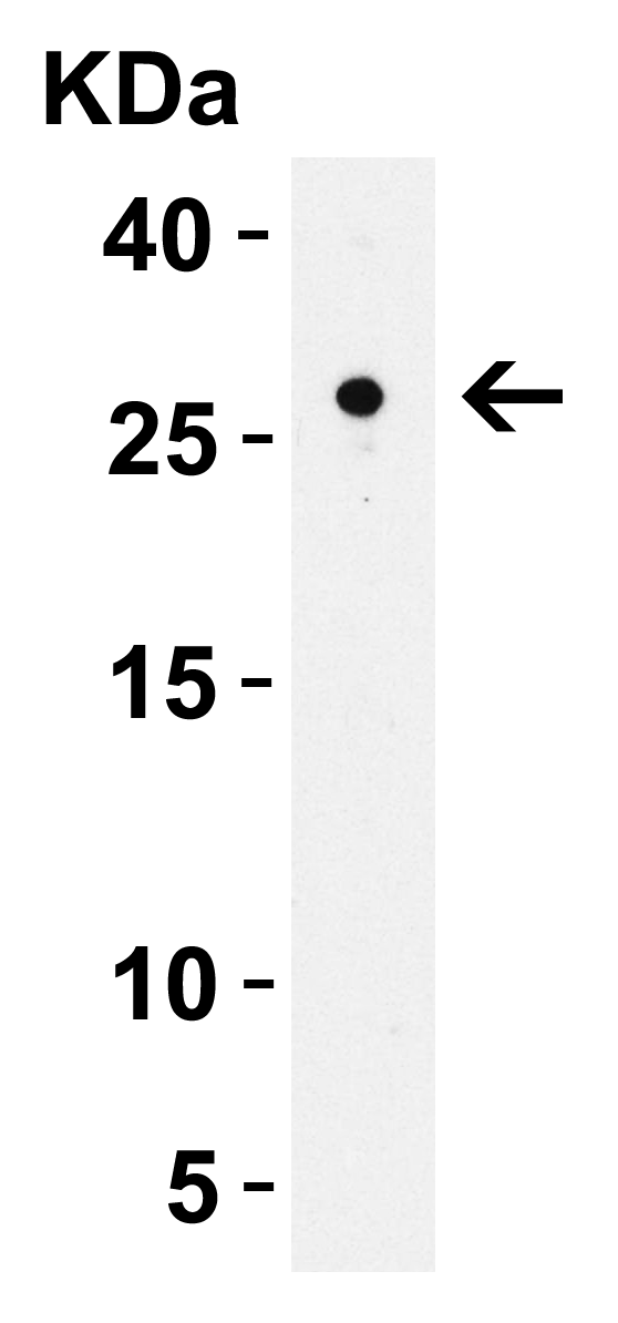 WB Validation in Rat Small Intestine
Loading: 15 μg of lysate Antibodies: CIDE-B, A07404-1, 2 μg/mL , 1 h incubation at RT in 5% NFDM/TBST