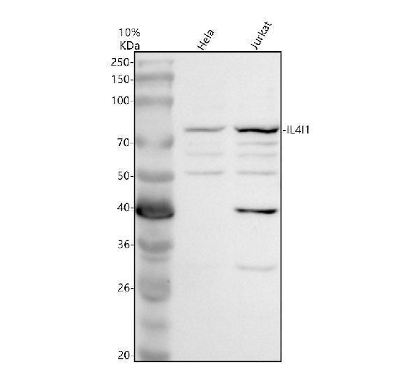 Western blot analysis of IL4I1 using anti-IL4I1 antibody (A07407-1)