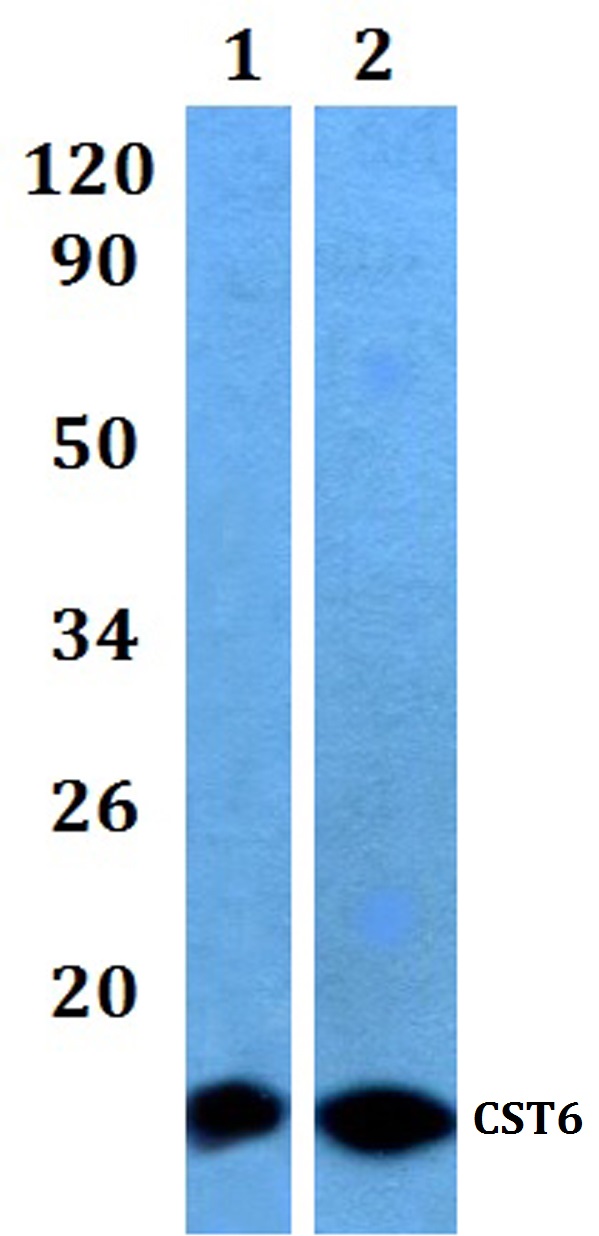 Western blot (WB) analysis of CST6 polyclonal antibody at 1:500 dilution
Lane1:HEK293T whole cell lysate
Lane2:PC12 whole cell lysate