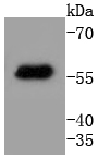 a07410 2 krt4 primary antiboties wb testing 1