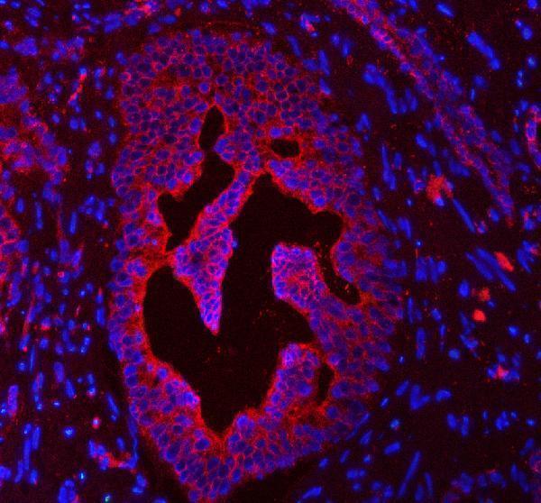 a07410 3 krt4 primary antibodies if testing 5