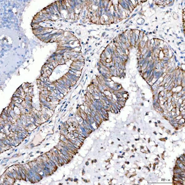  IHC analysis of Cytokeratin 4/KRT4 using anti-Cytokeratin 4/KRT4 antibody (A07410-3)