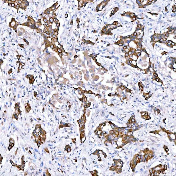 IHC analysis of Cytokeratin 4/KRT4 using anti-Cytokeratin 4/KRT4 antibody (A07410-3)