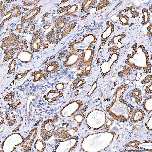 a07410 3 krt4 primary antibodies ihc testing 4