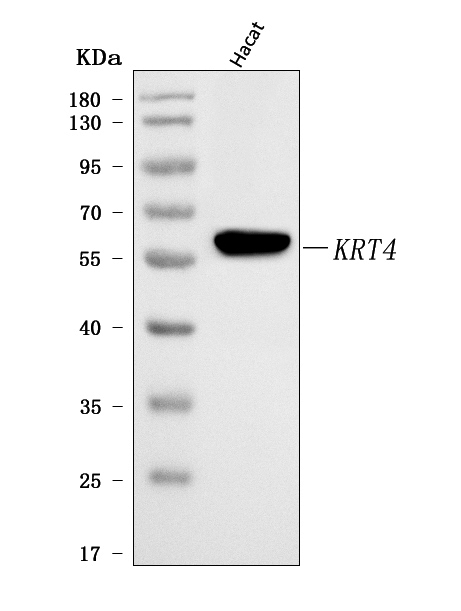  Western blot analysis of Cytokeratin 4/KRT4 using anti-Cytokeratin 4/KRT4 antibody (A07410-3)